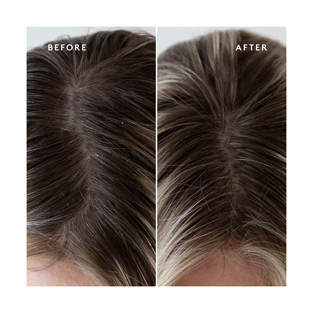 Virtue Refresh Exfoliating Scalp Treatment 150ml